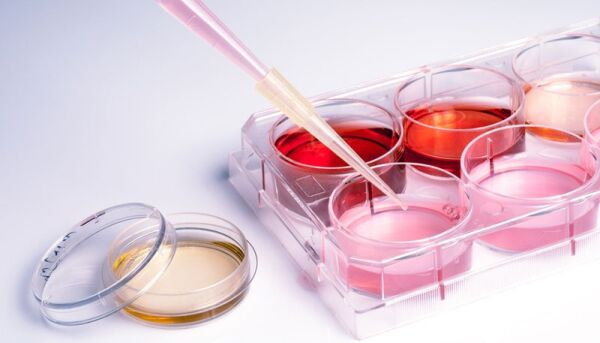 Bioteknologirådet vil regulere privat gentesting