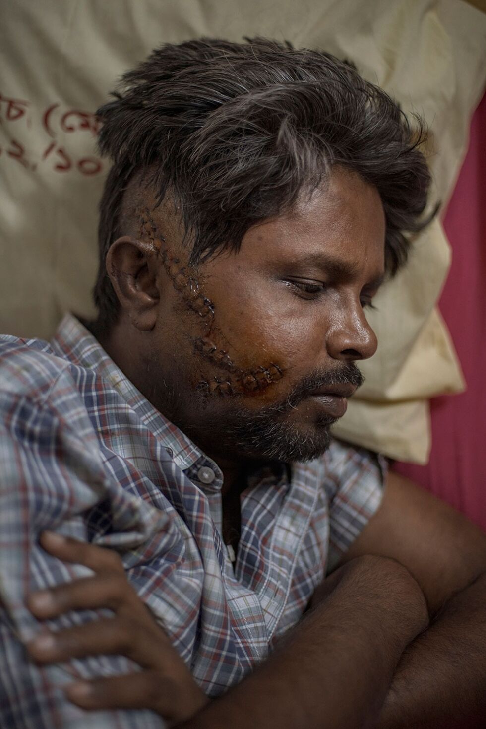 Ahmed Rashid Chowdhury «Tutul» på sykehuset i Dhaka, fem dager etter angrepet.
 Foto: Ismail Ferdous/Redux/NTB Scanpix