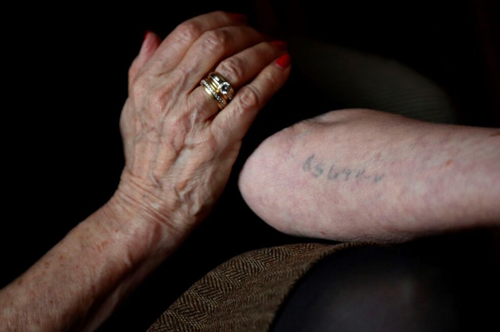 Det tatoverte fangenummeret synes fortsatt på Holocaust-overlevende Eva Umlaufs arm.
 Foto: NTB-Scanpix